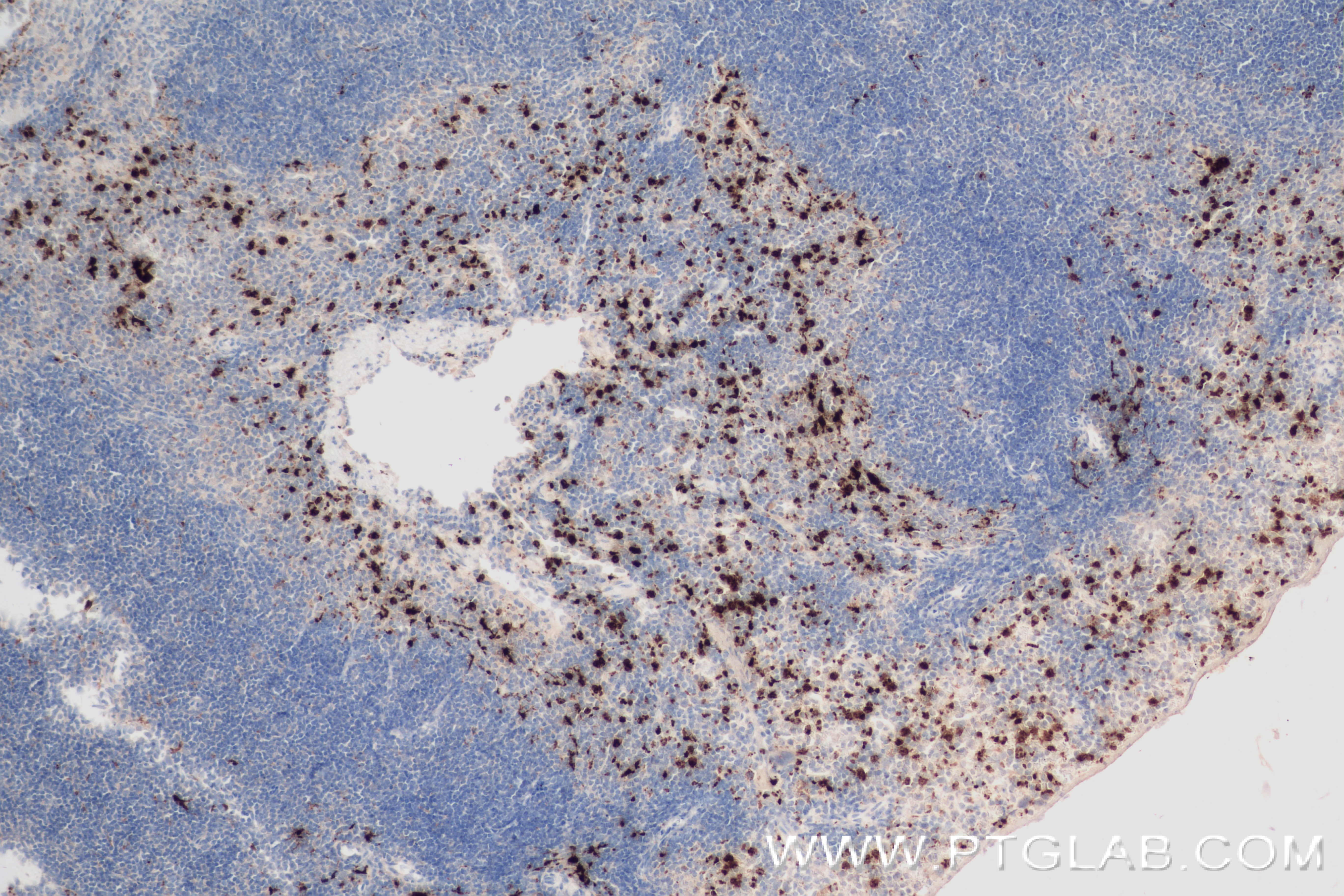 IHC staining of mouse spleen using 84436-5-RR