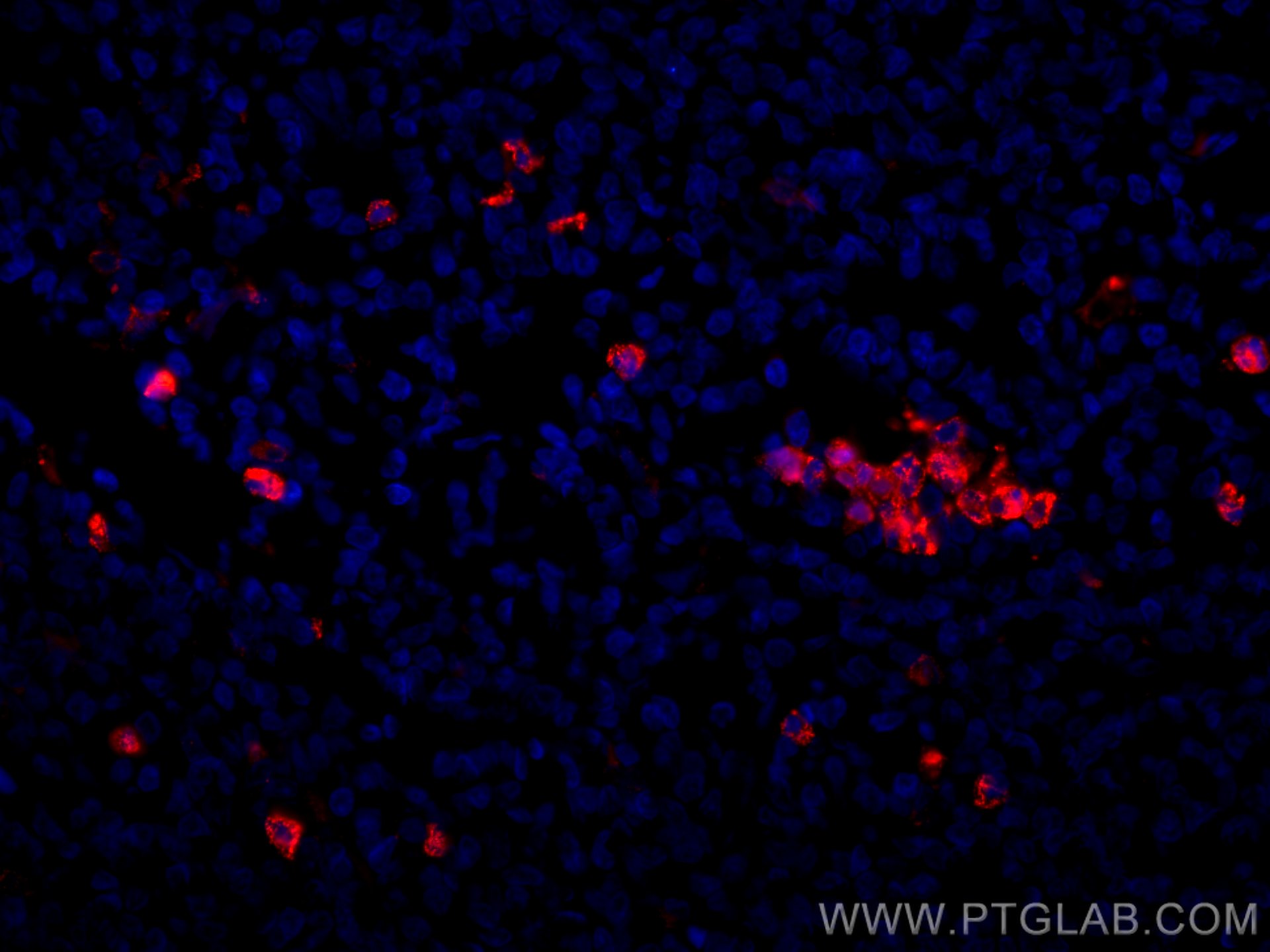 IF Staining of human tonsillitis using CL594-66177
