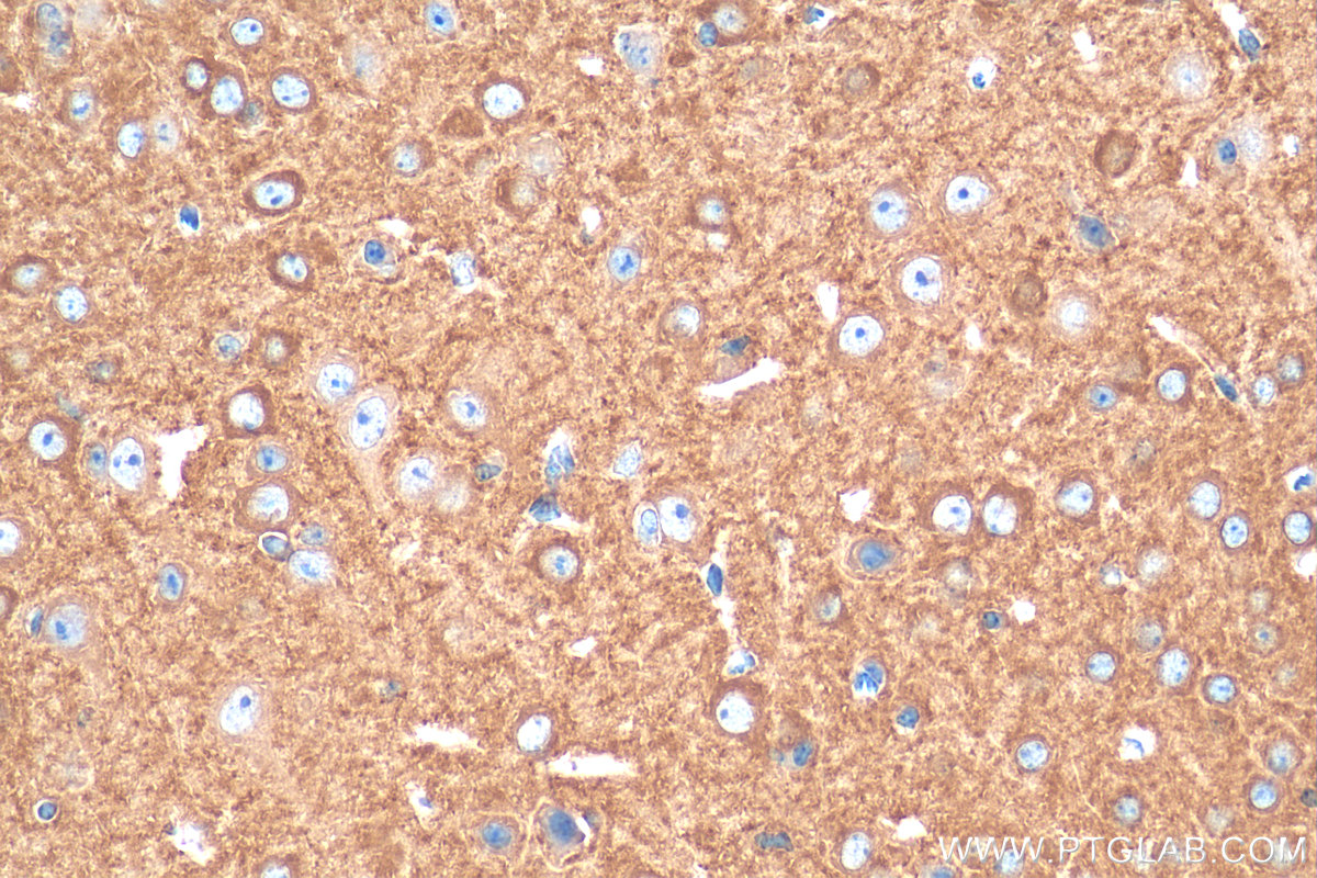 IHC staining of mouse brain using 13589-1-AP