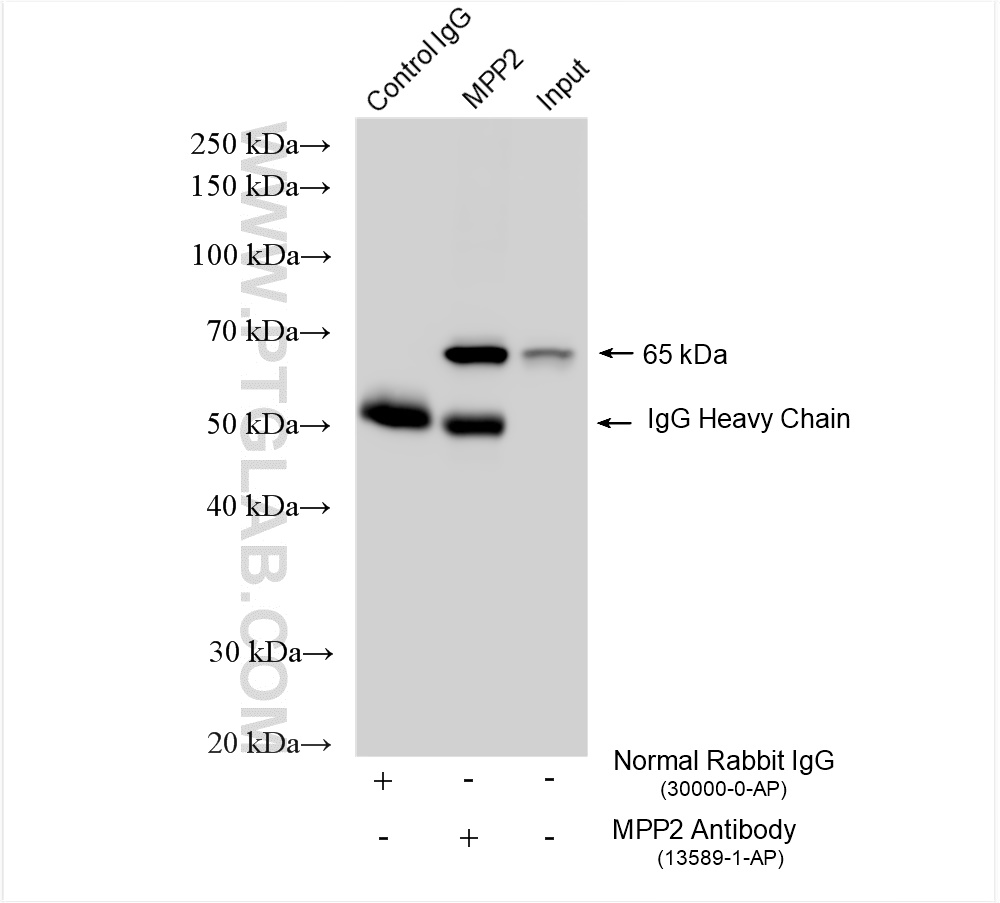 IP experiment of mouse eye using 13589-1-AP