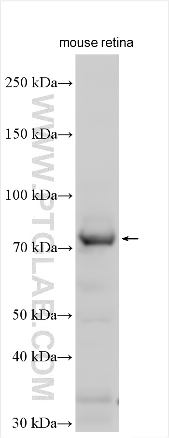 WB analysis of mouse retina using 25538-1-AP