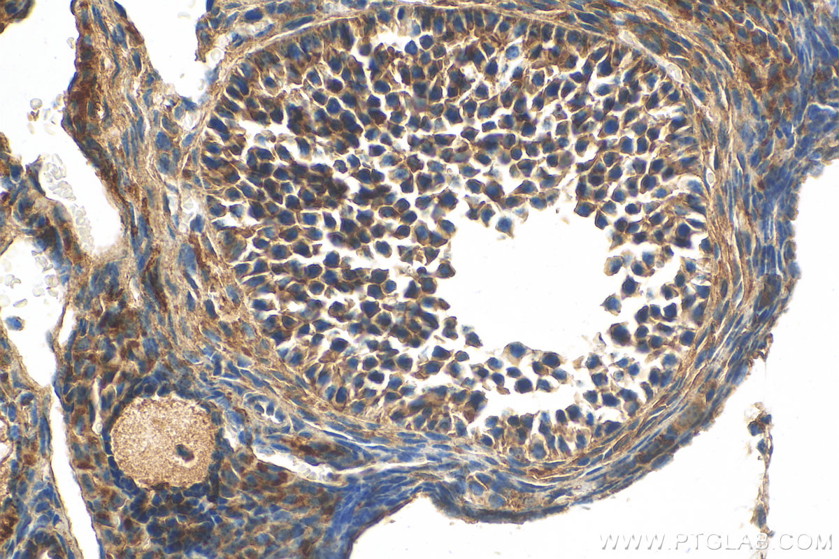 IHC staining of mouse ovary using 20040-1-AP