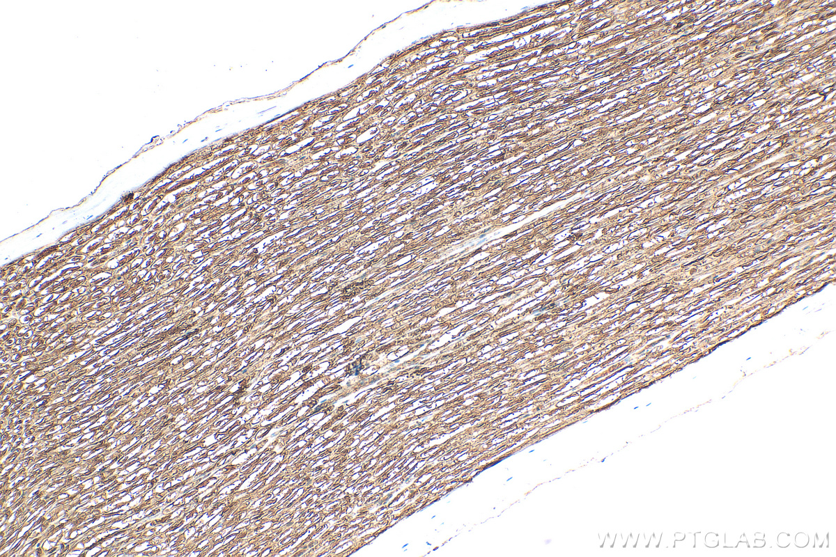 IHC staining of rat Ischiadic nerve using 10572-1-AP