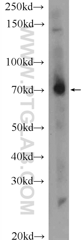 WB analysis of mouse liver using 25513-1-AP