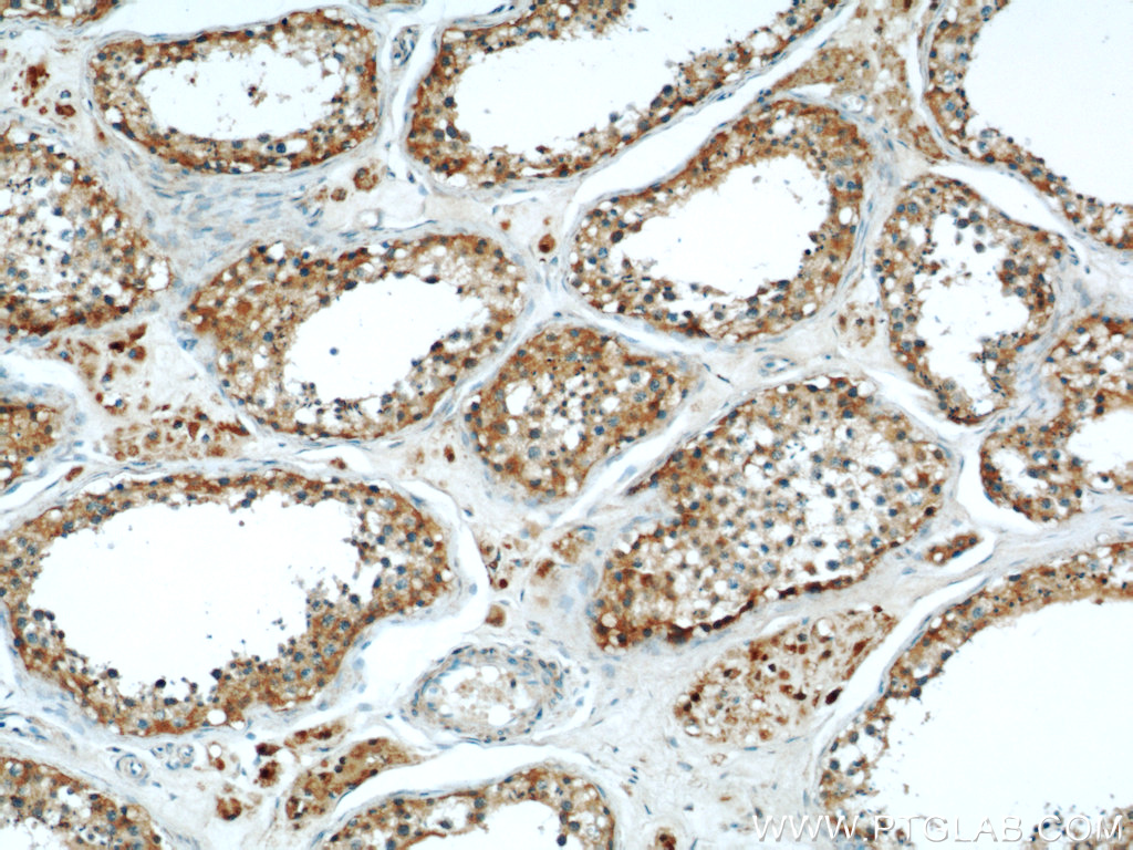 IHC staining of human testis using 19512-1-AP