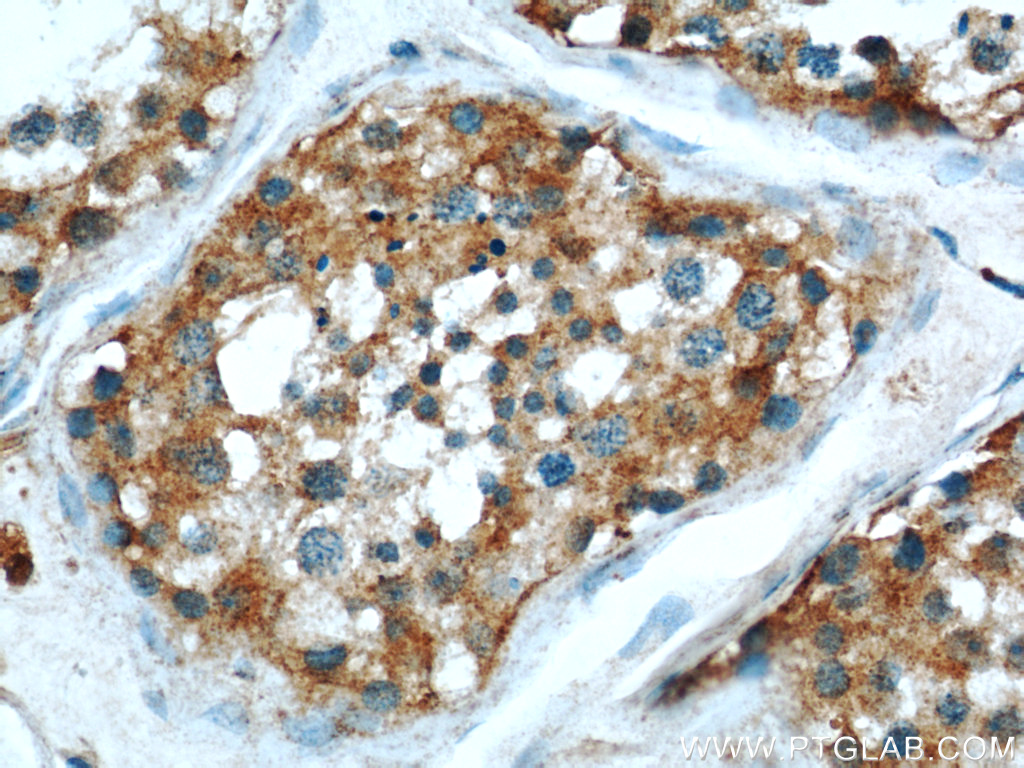 IHC staining of human testis using 19512-1-AP