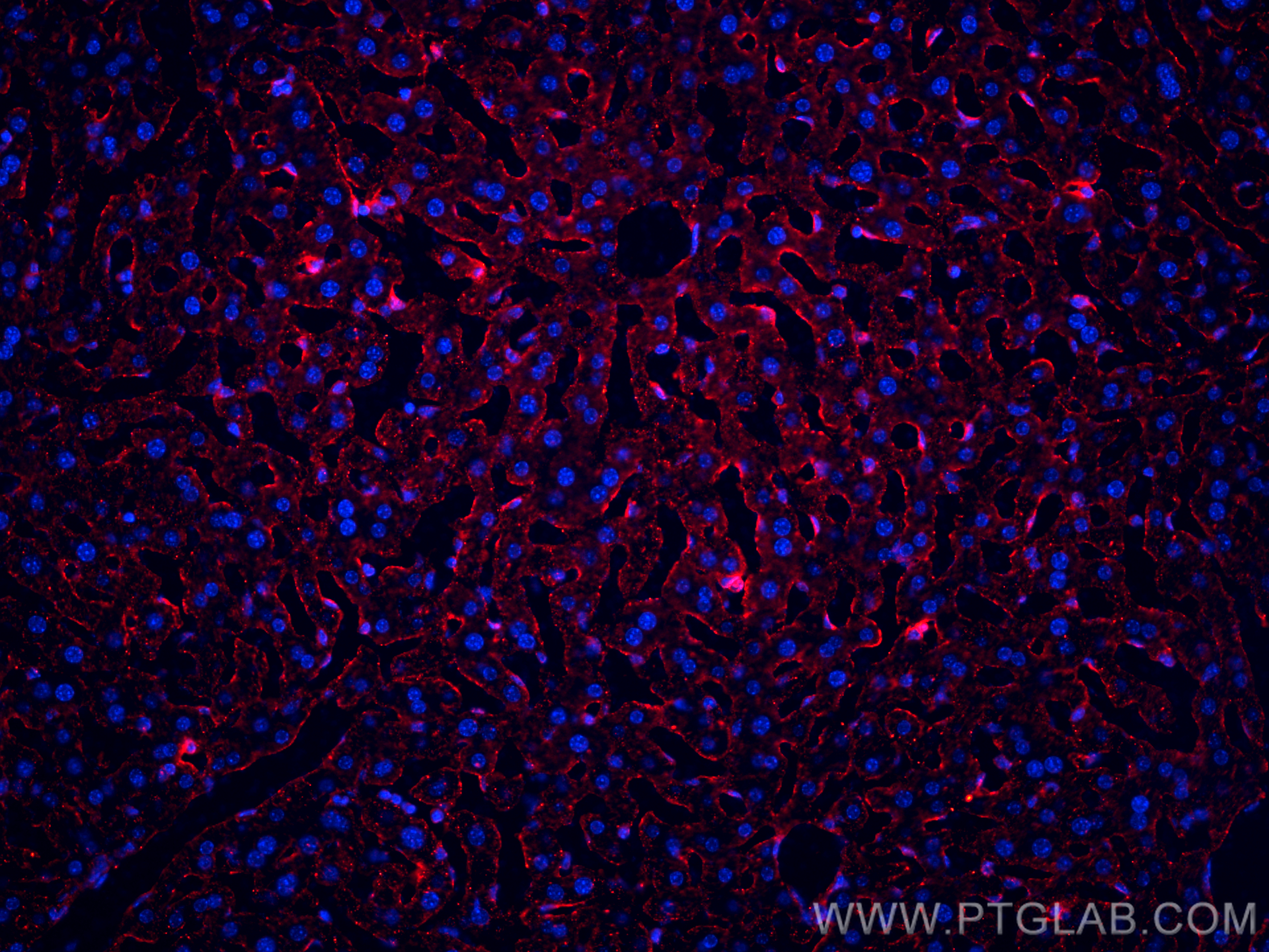 IF Staining of mouse liver using 18704-1-AP