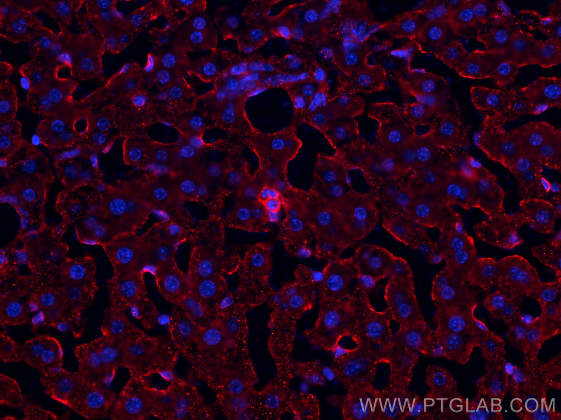 IF Staining of mouse liver using 18704-1-AP