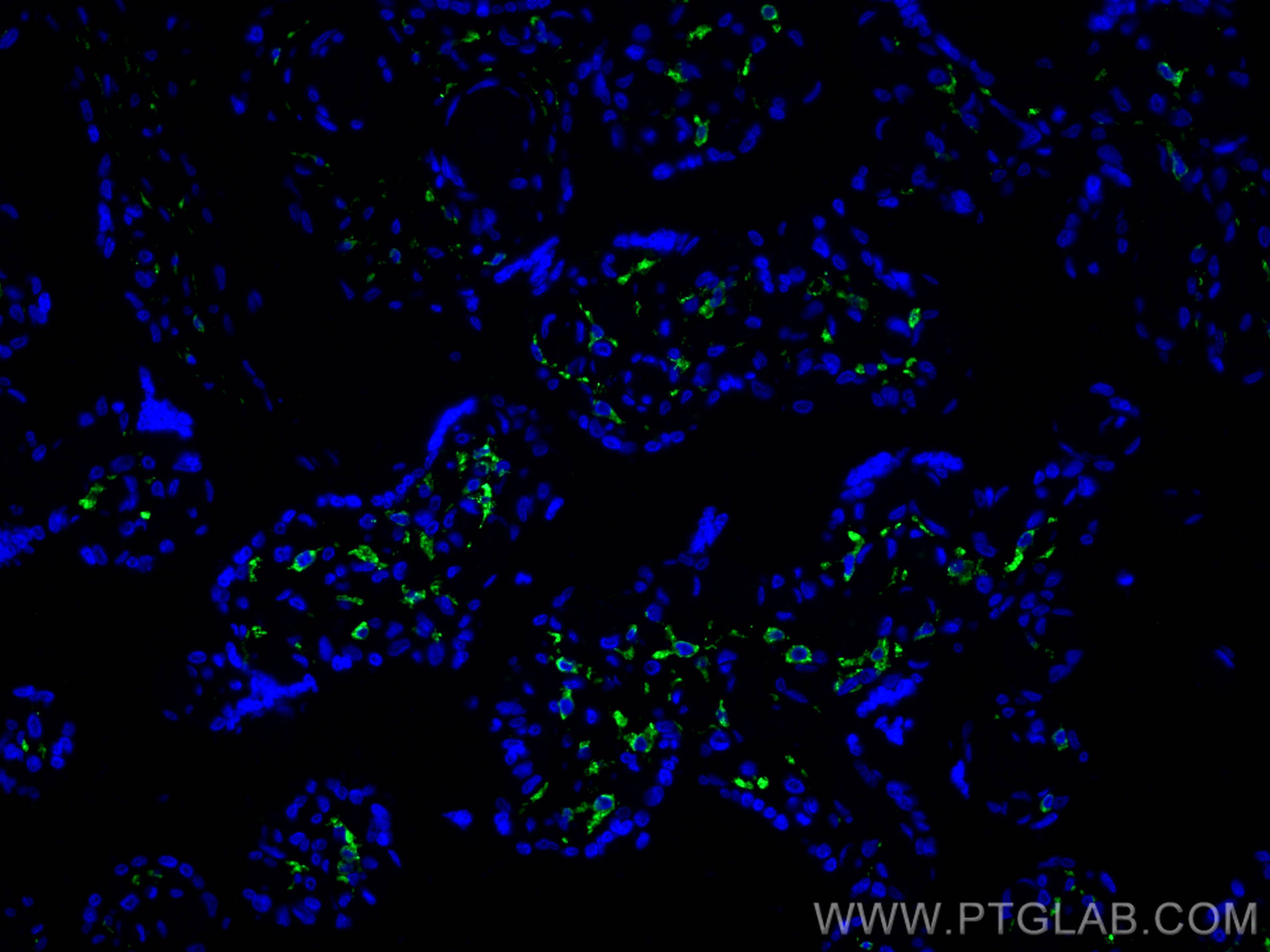 IF Staining of human placenta using 81525-1-RR (same clone as 81525-1-PBS)