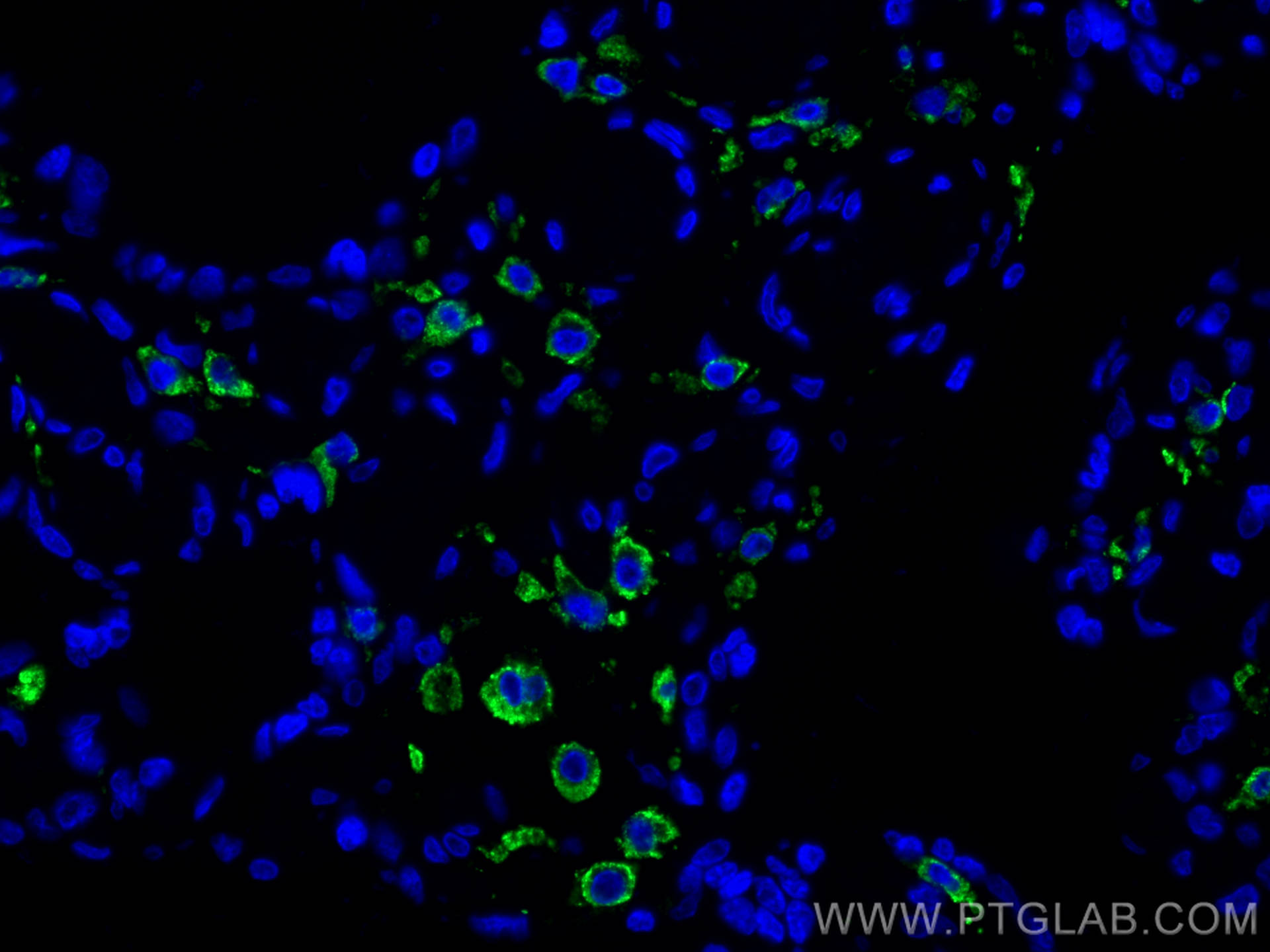 IF Staining of human placenta using 81525-1-RR