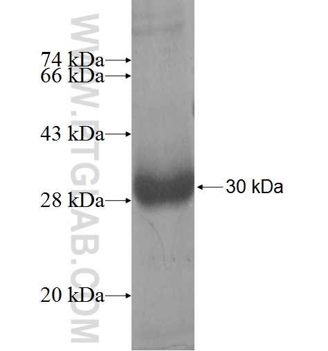 MREG fusion protein Ag5416 SDS-PAGE