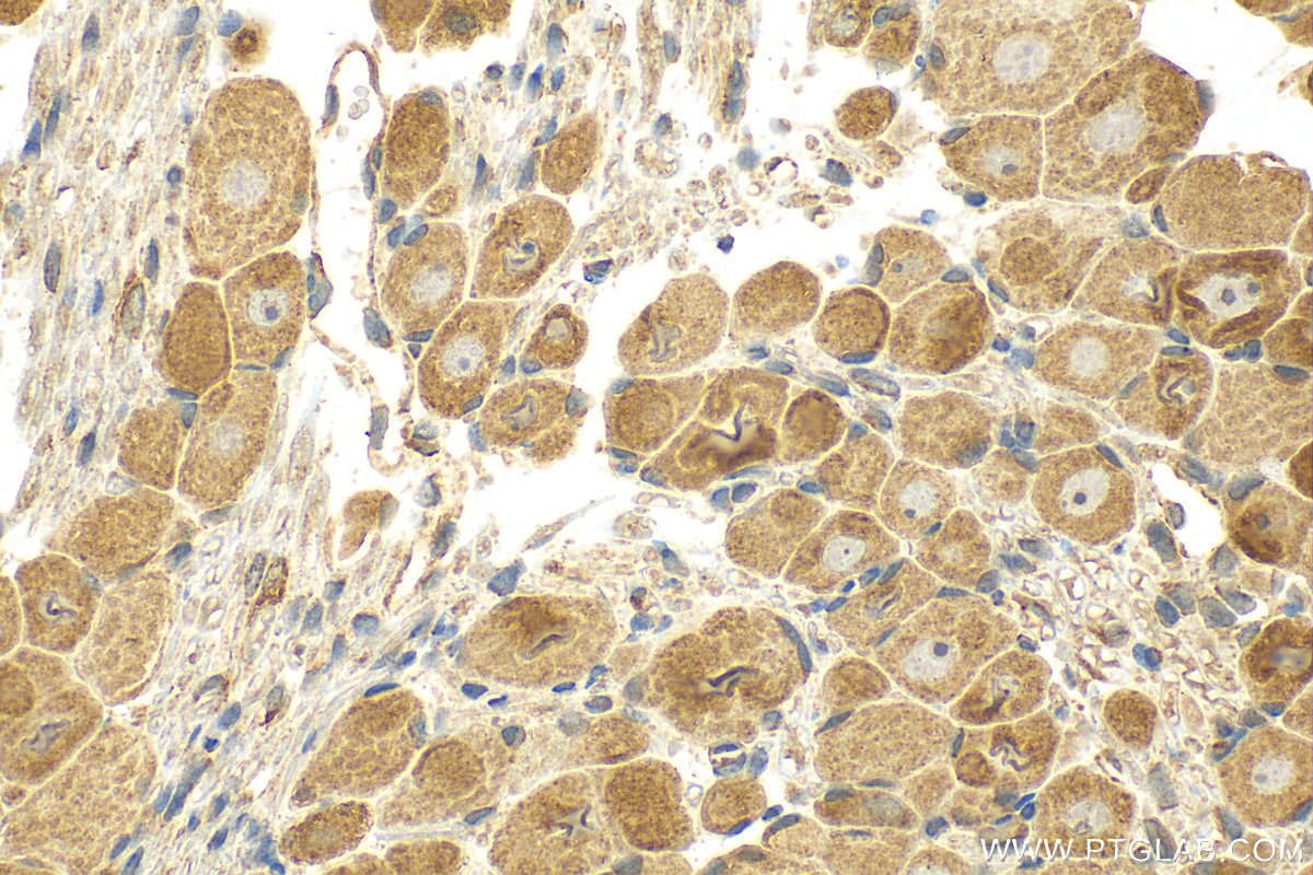 IHC staining of rat dorsal root ganglion using 17946-1-AP