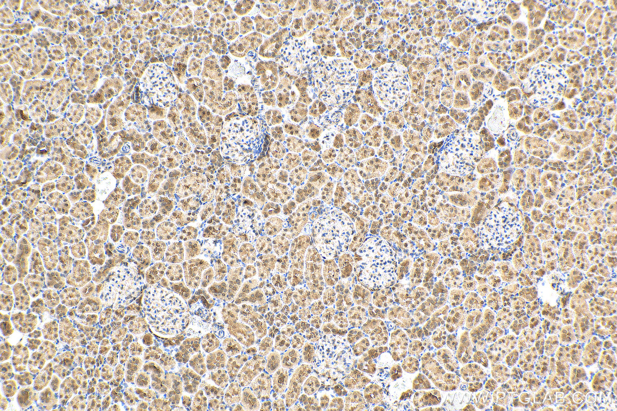 IHC staining of rat kidney using 19916-1-AP