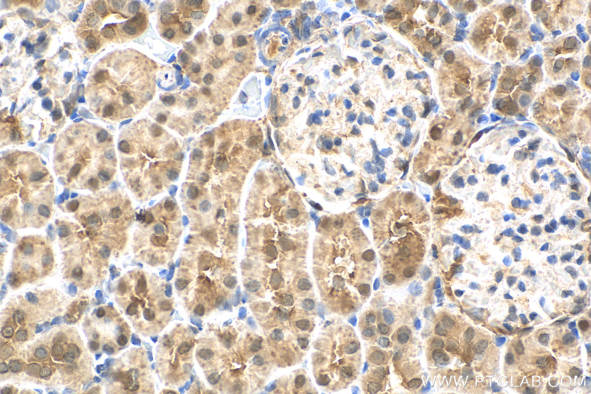 IHC staining of rat kidney using 19916-1-AP