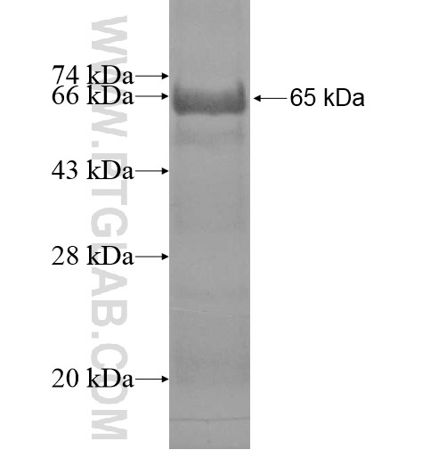 MRI1 fusion protein Ag13809 SDS-PAGE