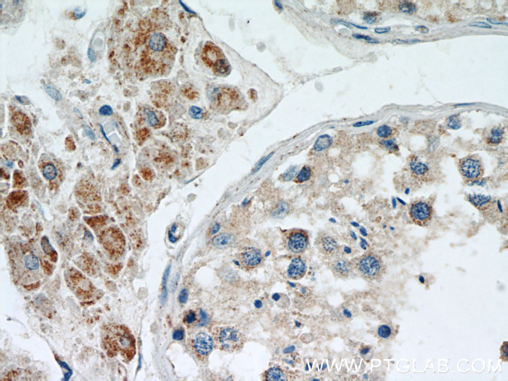 IHC staining of human testis using 16652-1-AP