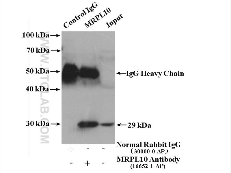 IP experiment of mouse liver using 16652-1-AP