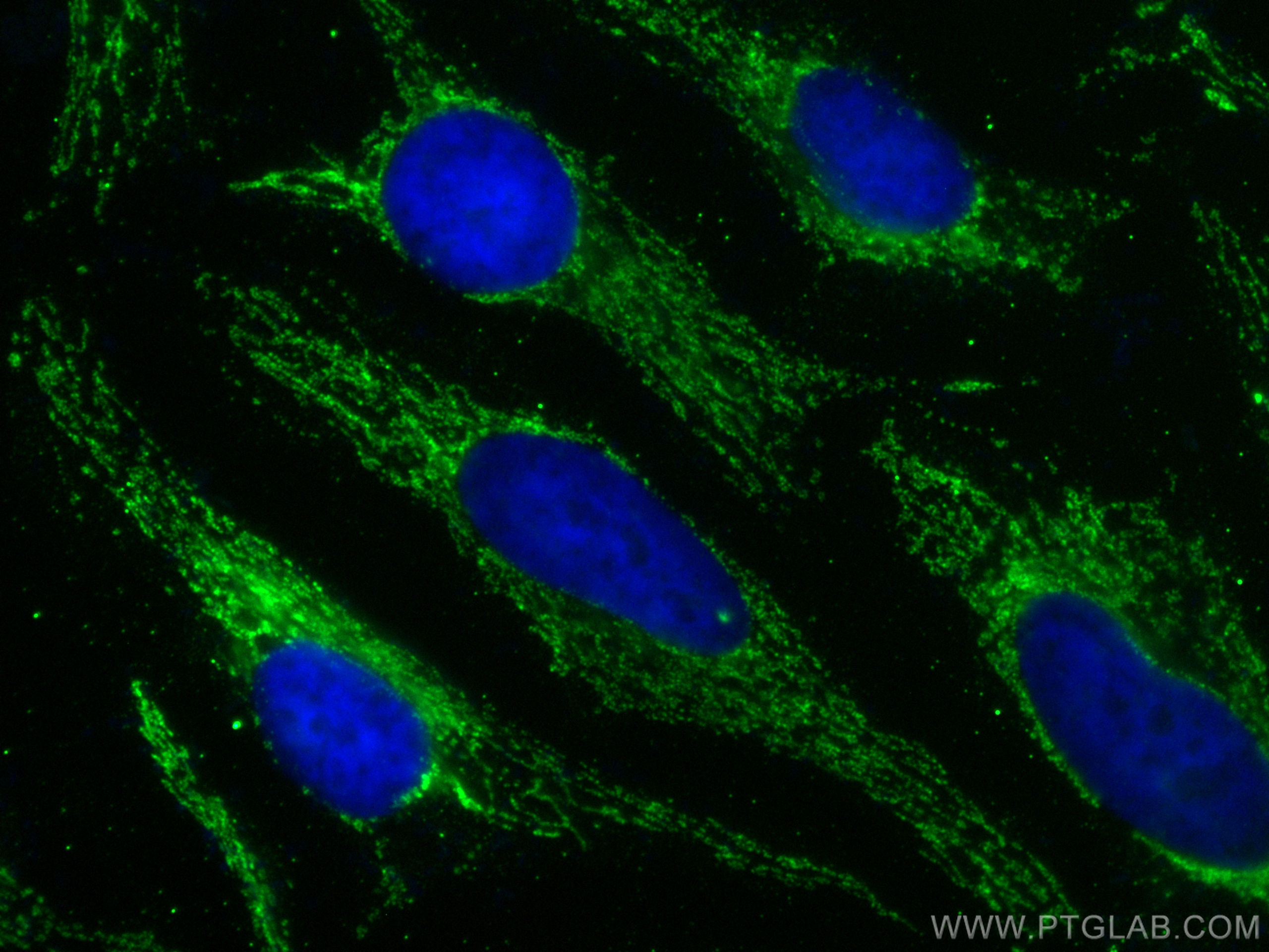 IF Staining of HeLa using 68623-1-Ig (same clone as 68623-1-PBS)