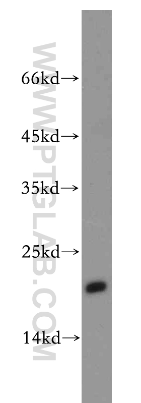 WB analysis of A2780 using 11706-1-AP