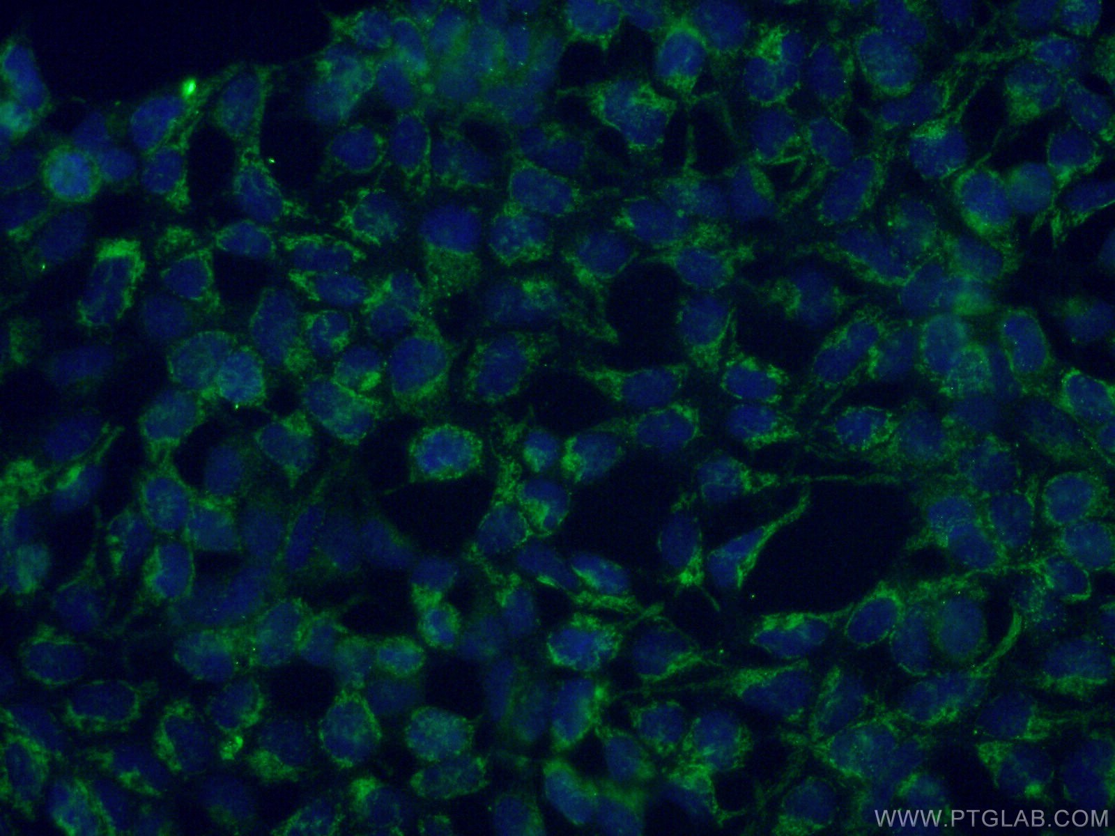 IF Staining of HEK-293 using 66595-1-Ig