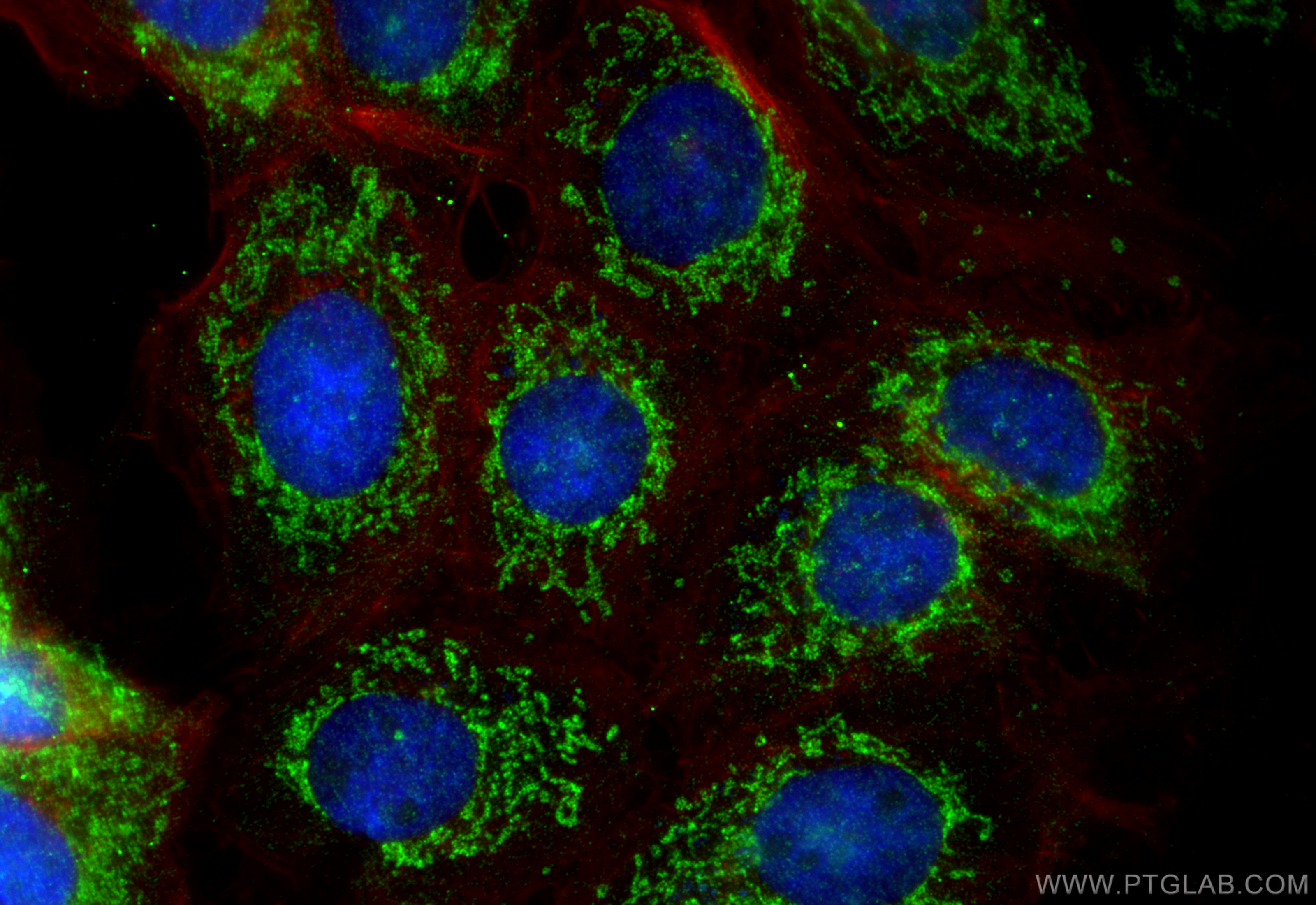 IF Staining of A431 using 14765-1-AP