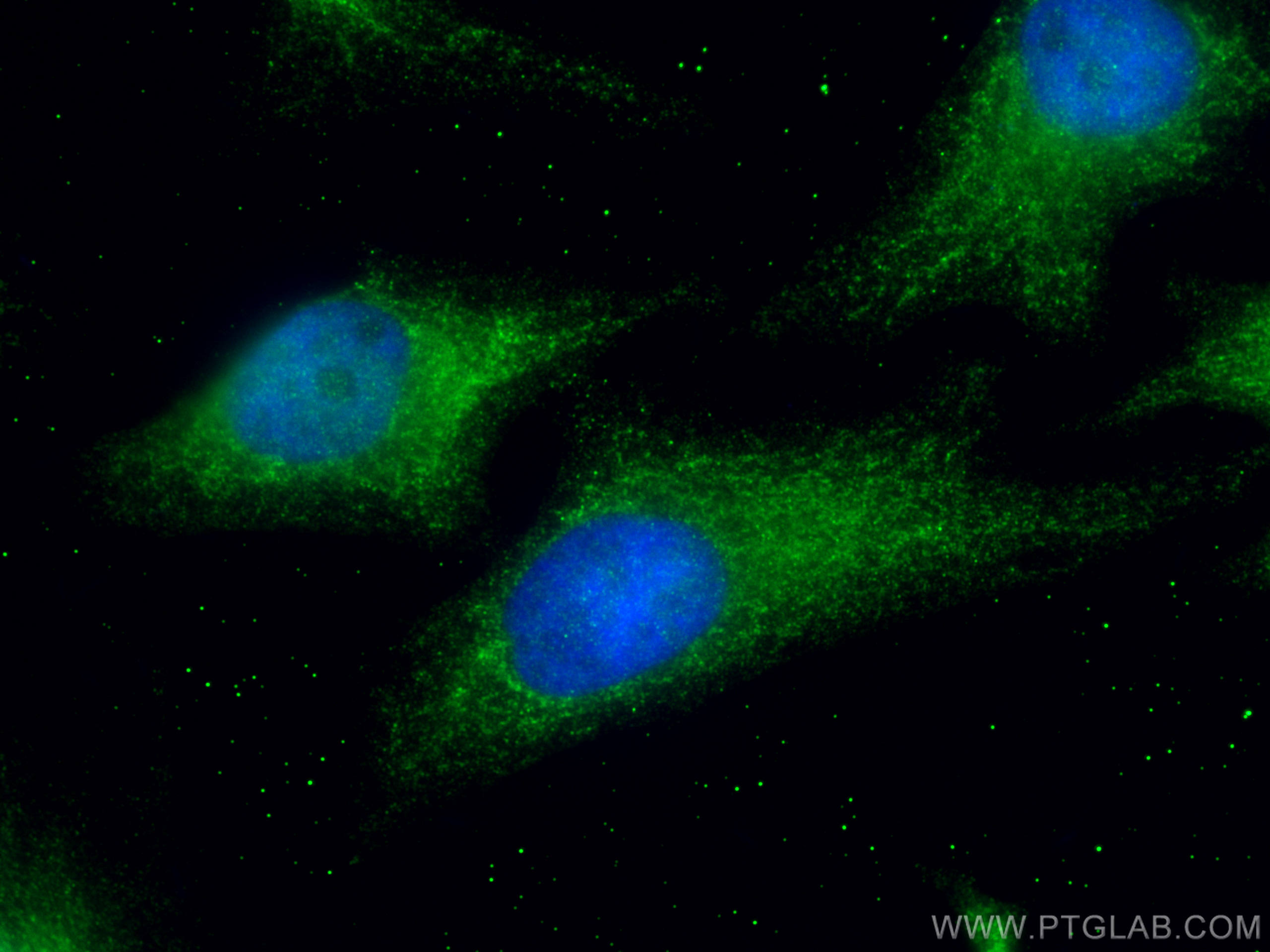 IF Staining of HeLa using 21604-1-AP