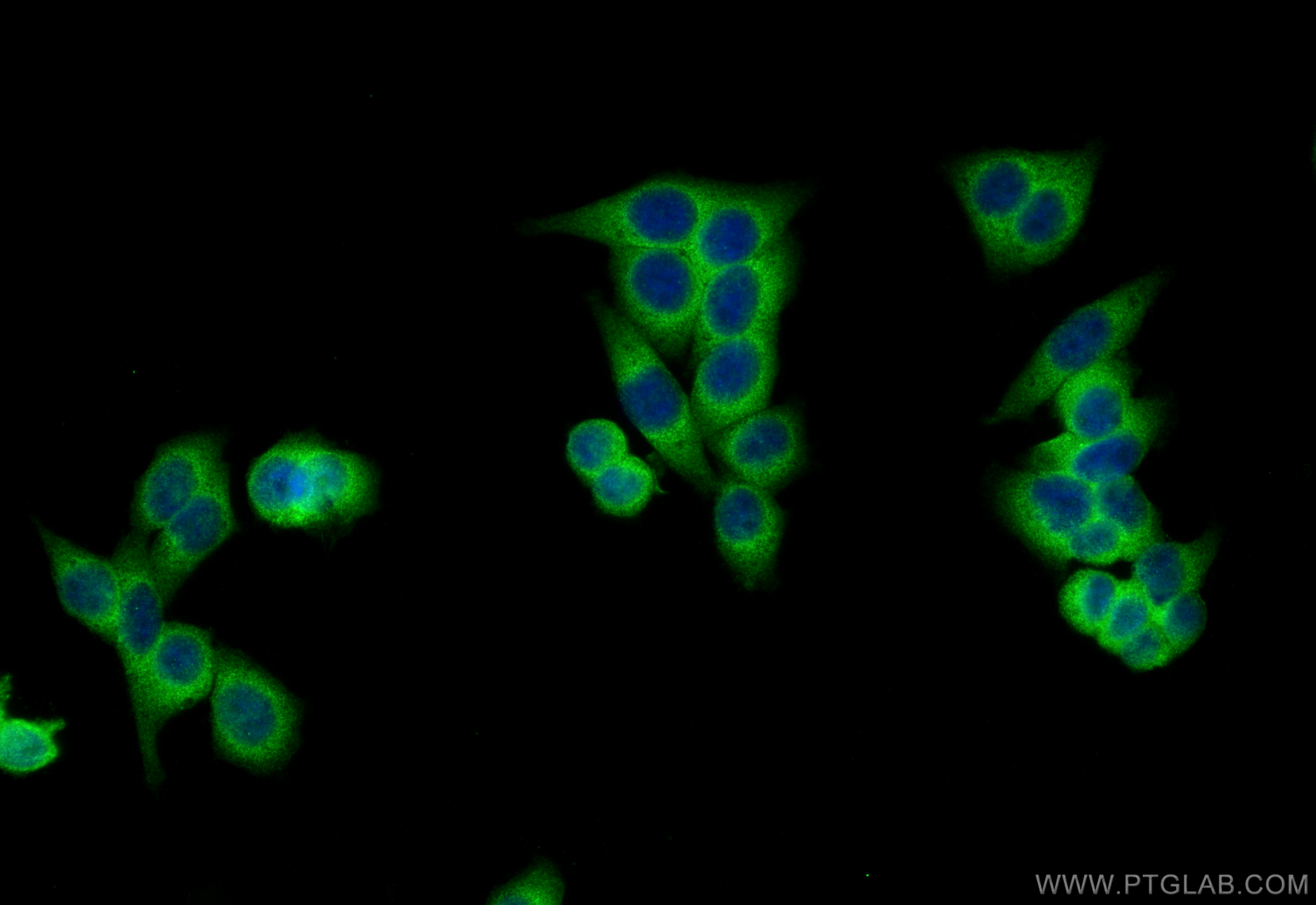 IF Staining of HepG2 using 27339-1-AP