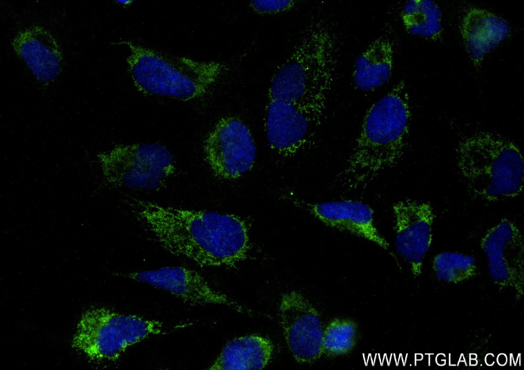 IF Staining of HeLa using 83515-4-RR