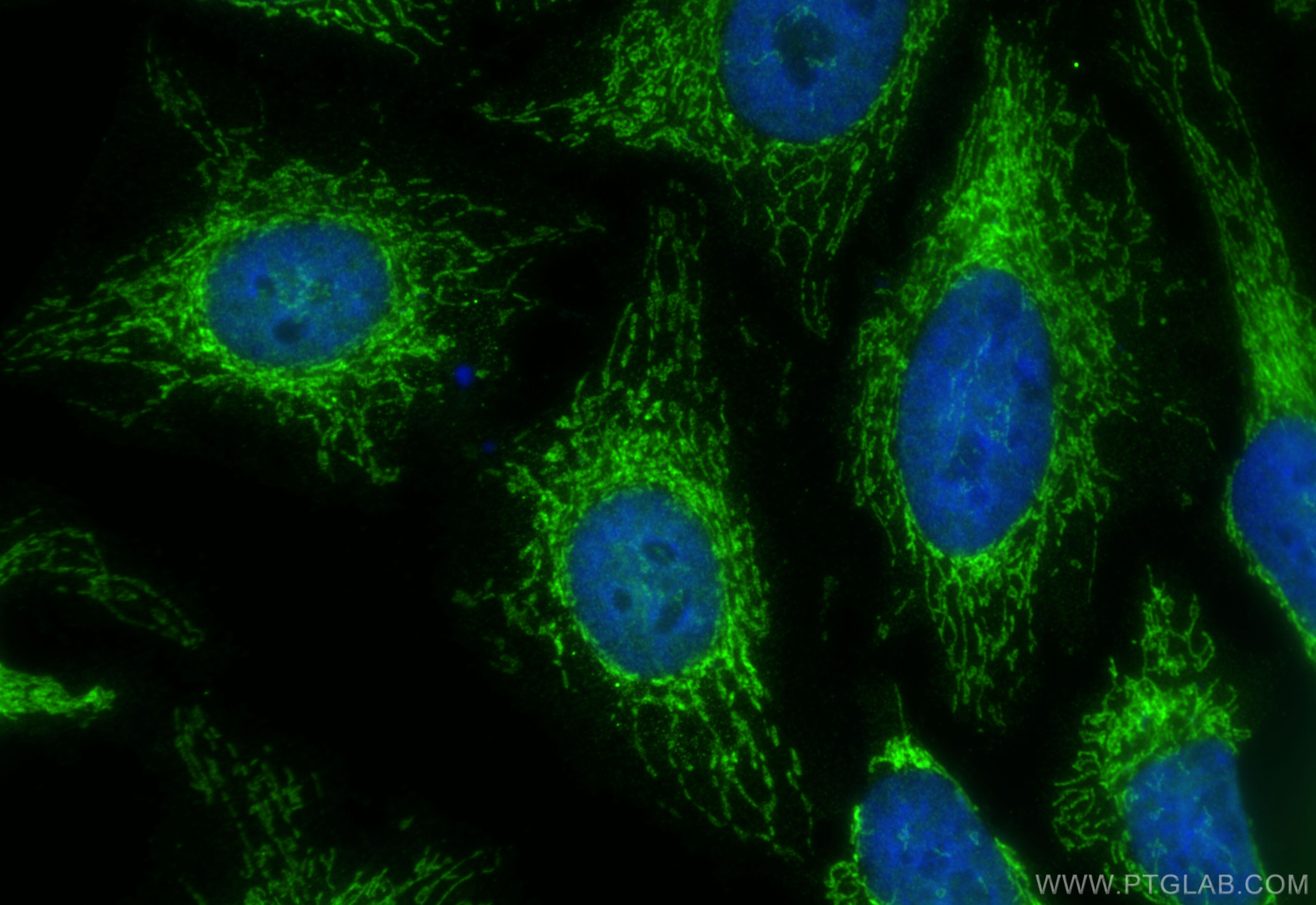 IF Staining of HeLa using 15682-1-AP