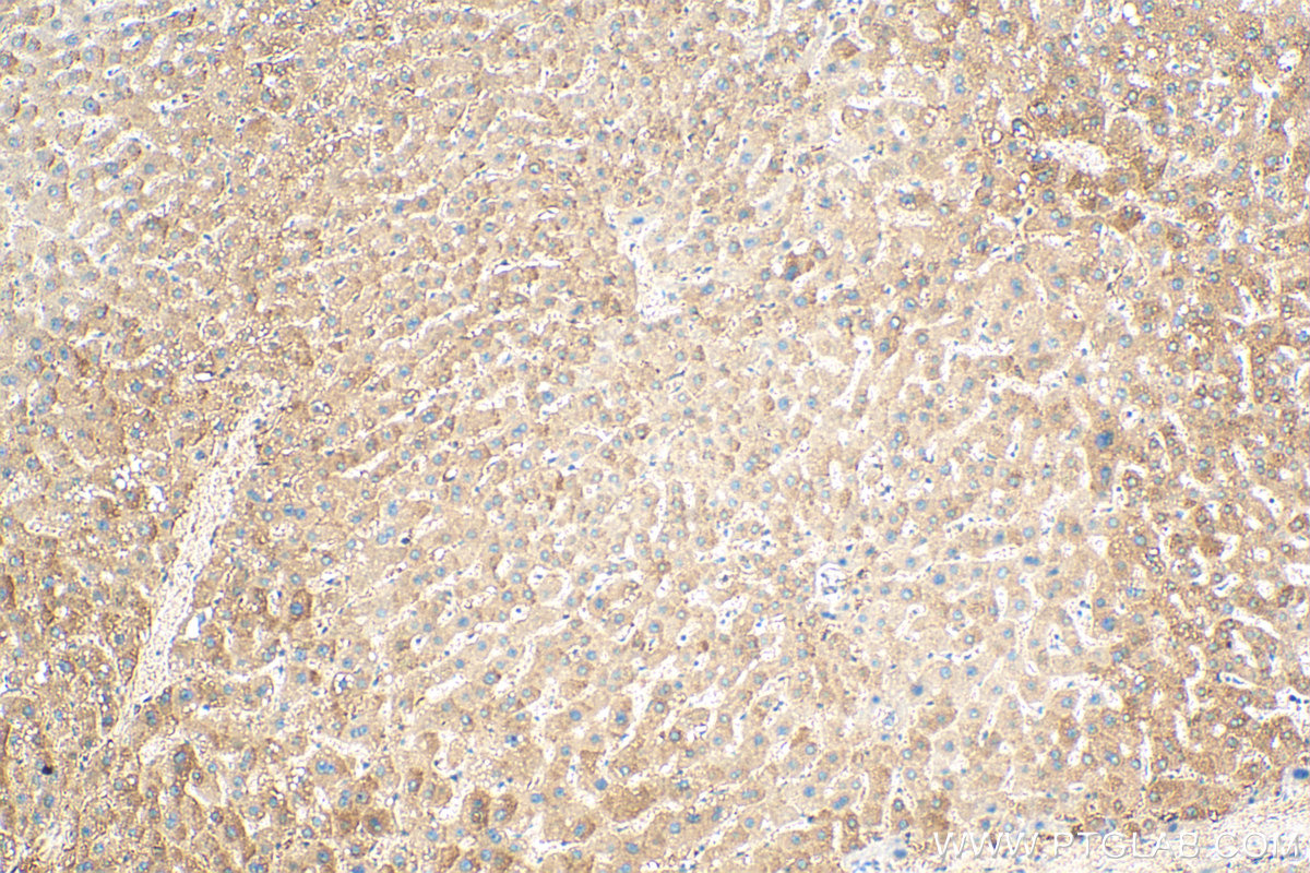 IHC staining of human liver using 17213-1-AP