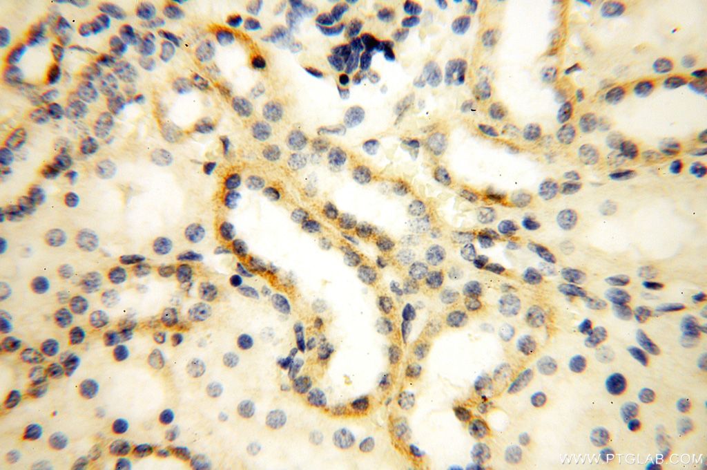 IHC staining of human kidney using 16800-1-AP