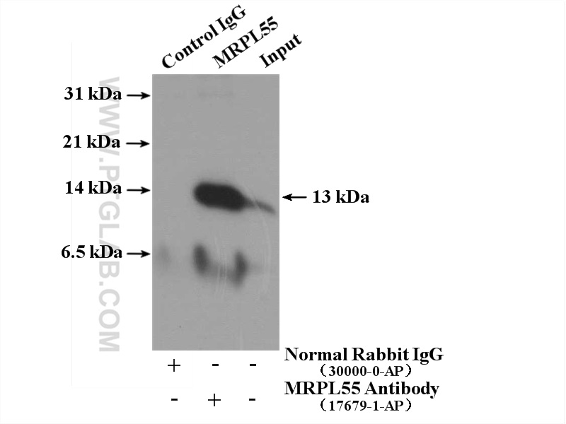 IP experiment of HEK-293 using 17679-1-AP