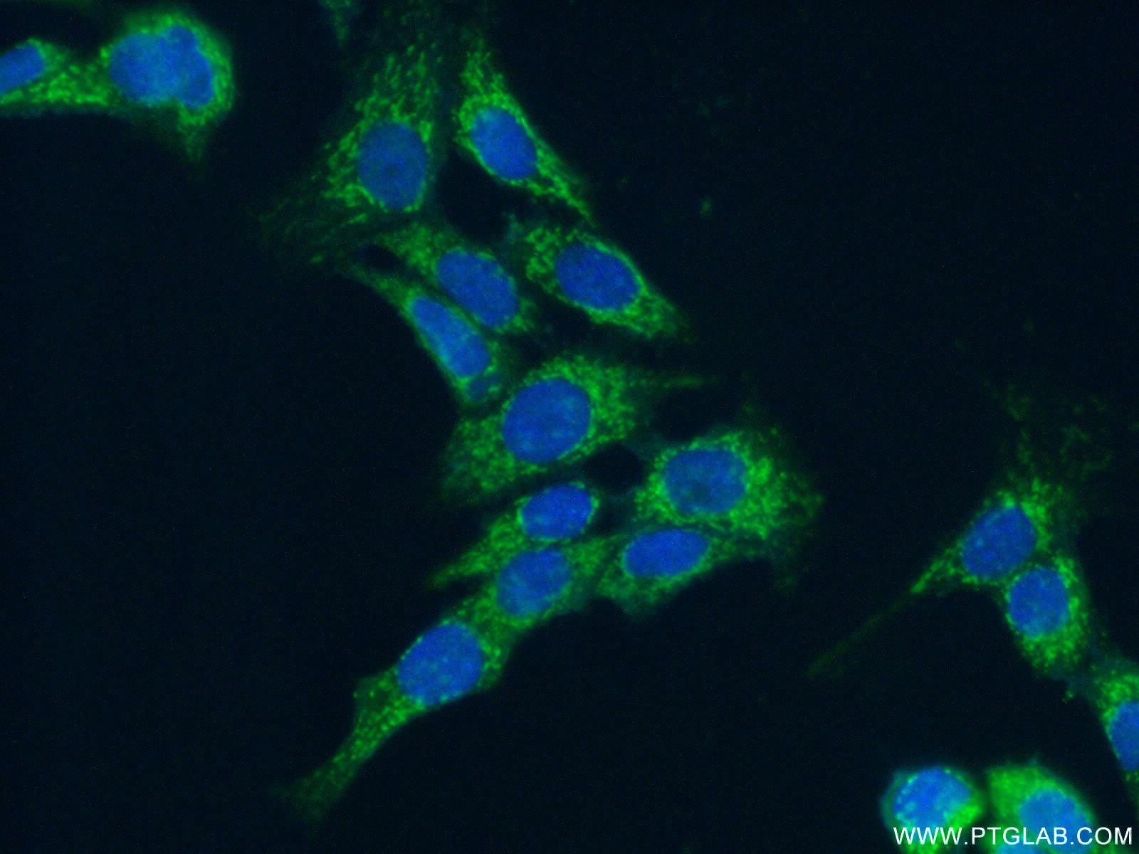 IF Staining of MCF-7 using 15342-1-AP