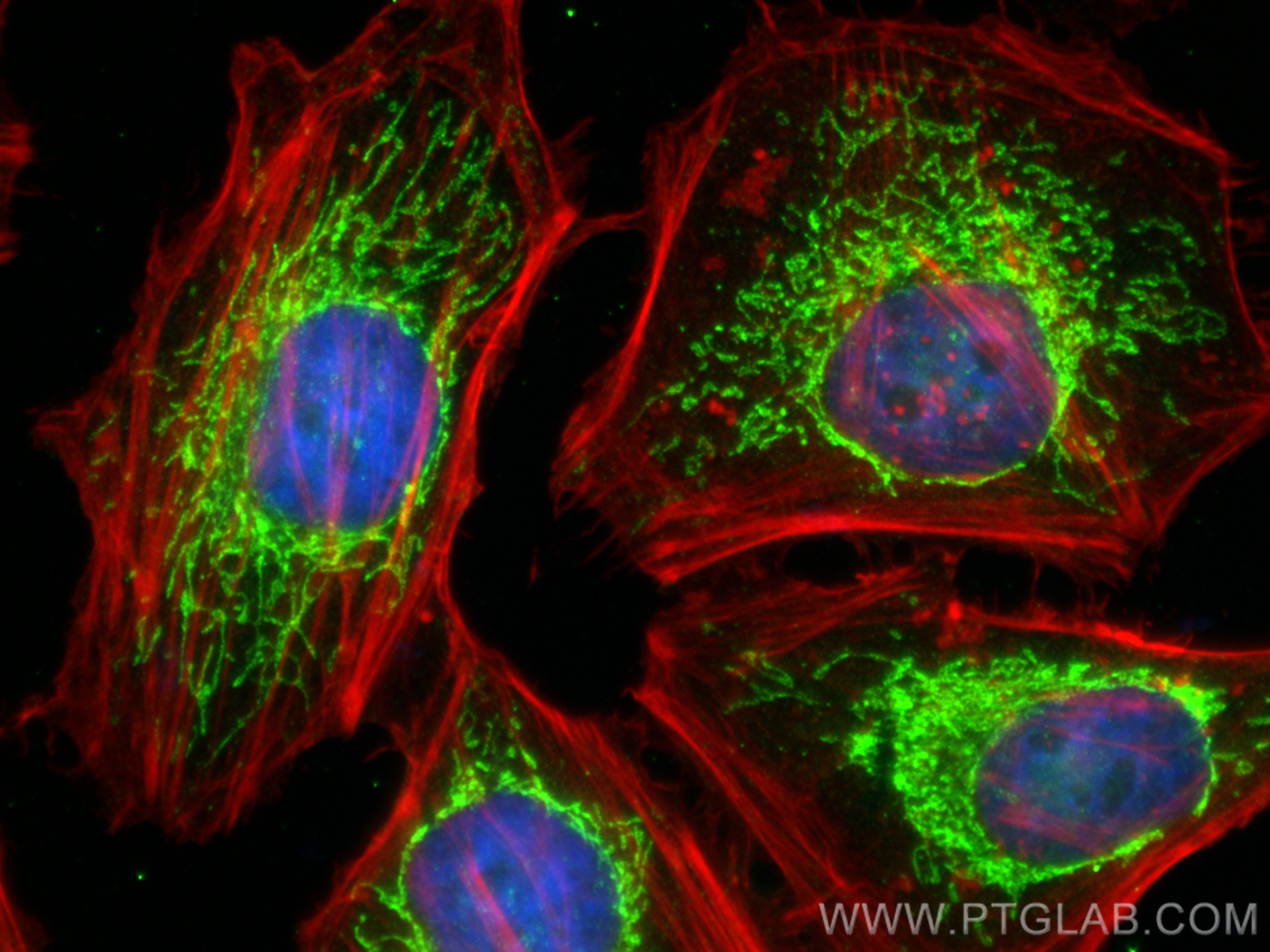 IF Staining of HeLa using 17006-1-AP