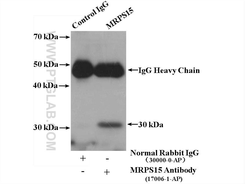 IP experiment of mouse brain using 17006-1-AP