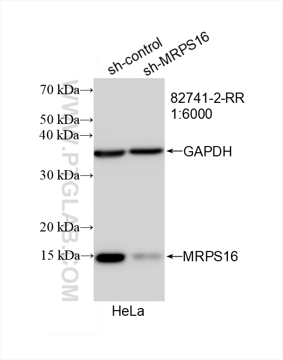 WB analysis of HeLa using 82741-2-RR (same clone as 82741-2-PBS)