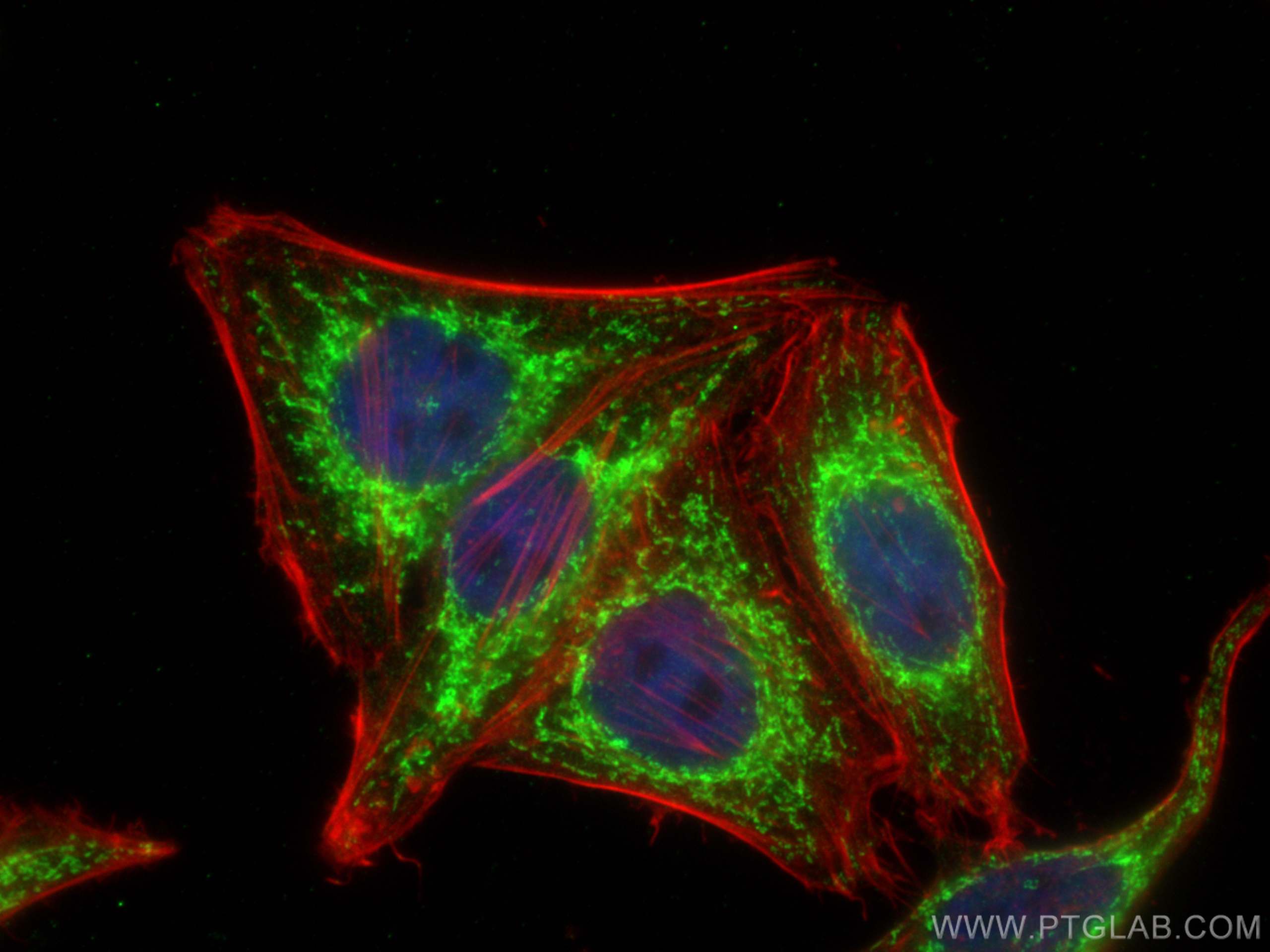 IF Staining of HepG2 using 18881-1-AP