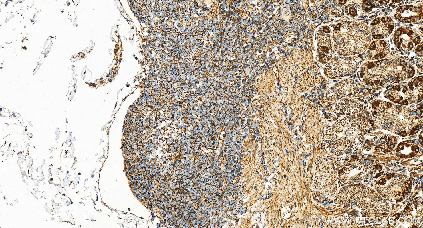 IHC staining of human stomach using 16235-1-AP