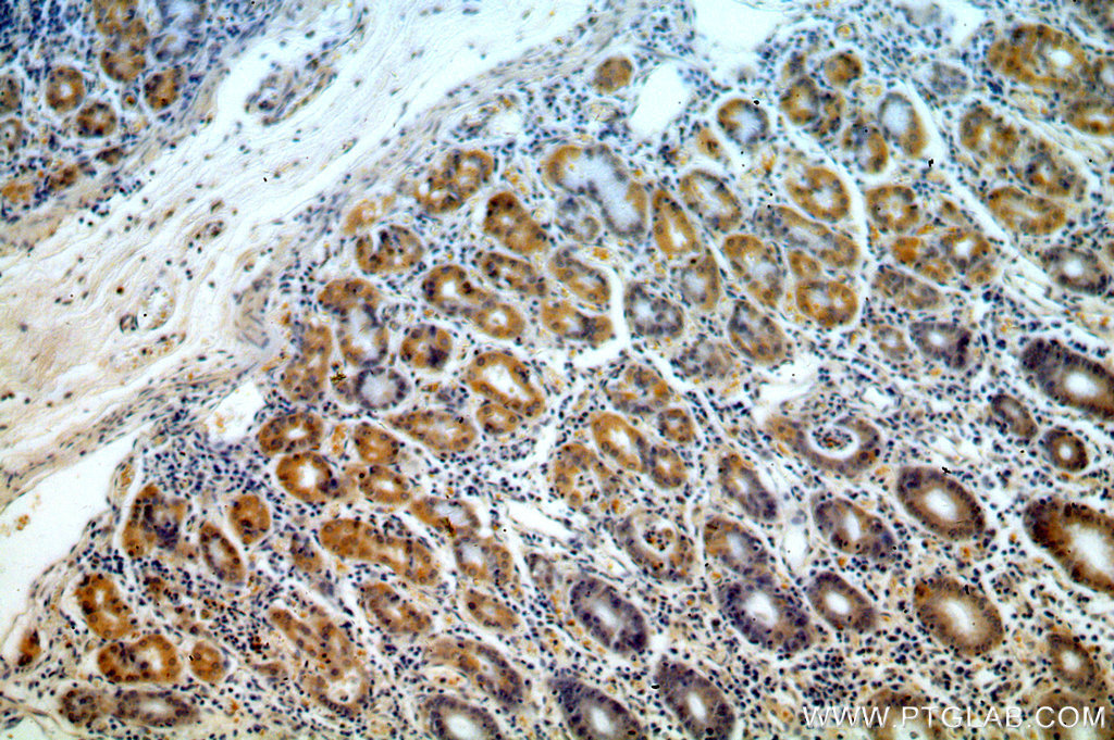 IHC staining of human stomach using 15907-1-AP