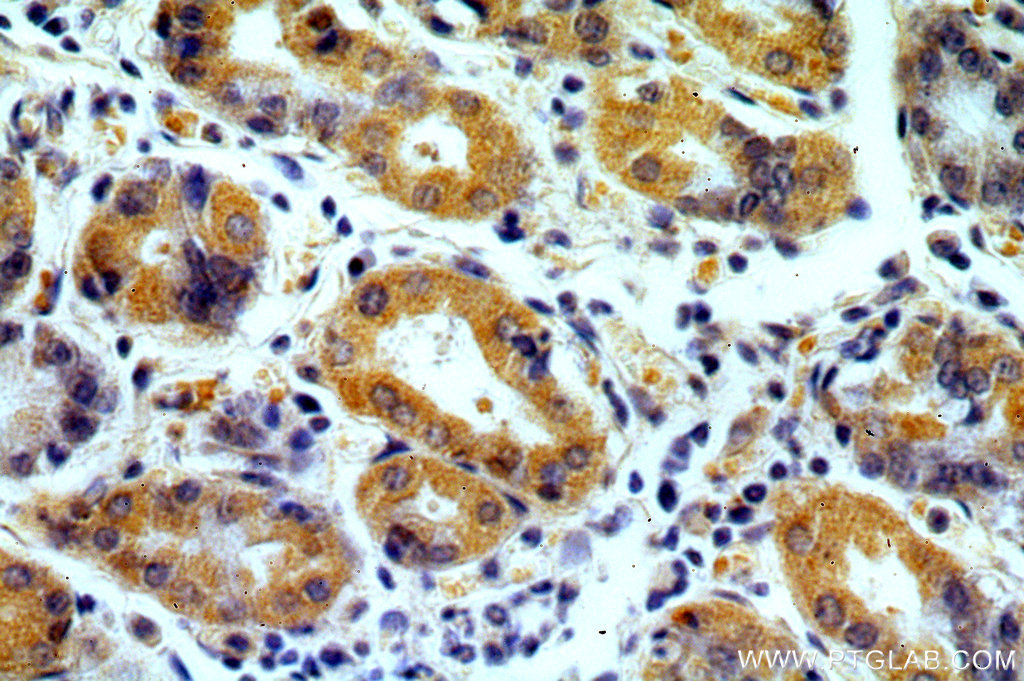 IHC staining of human stomach using 15907-1-AP