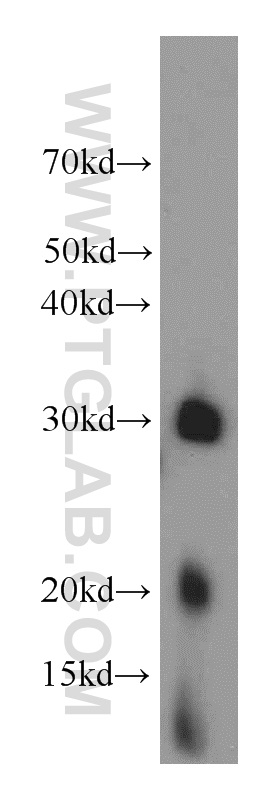 WB analysis of mouse brain using 15907-1-AP