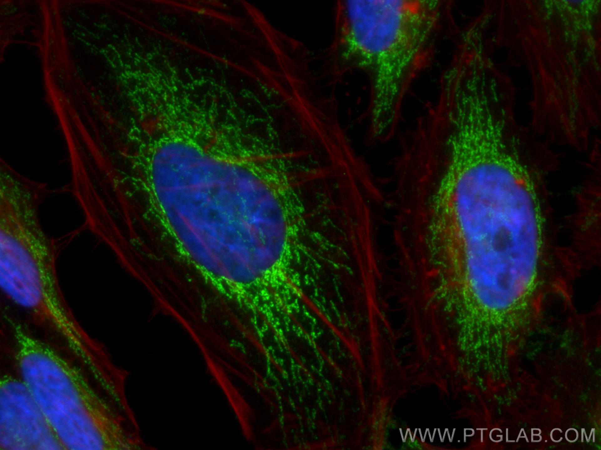 IF Staining of HeLa using 18345-1-AP