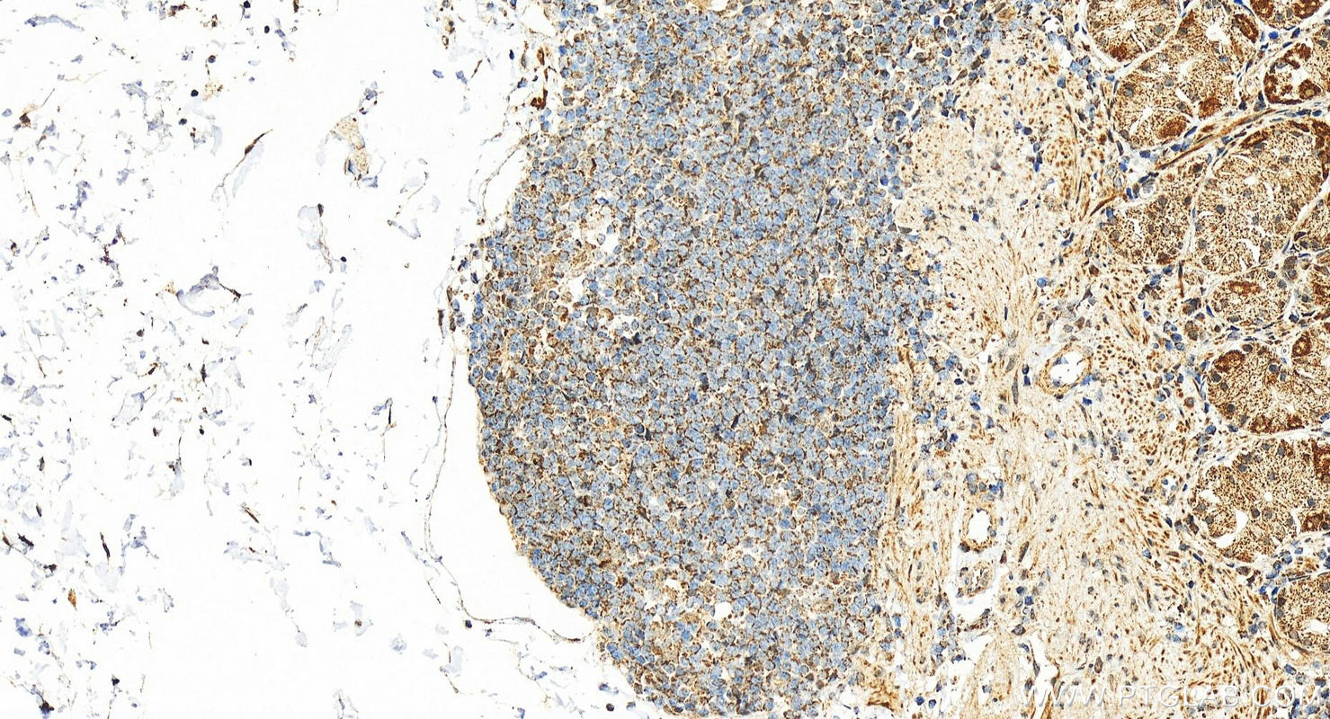 IHC staining of human stomach using 16213-1-AP