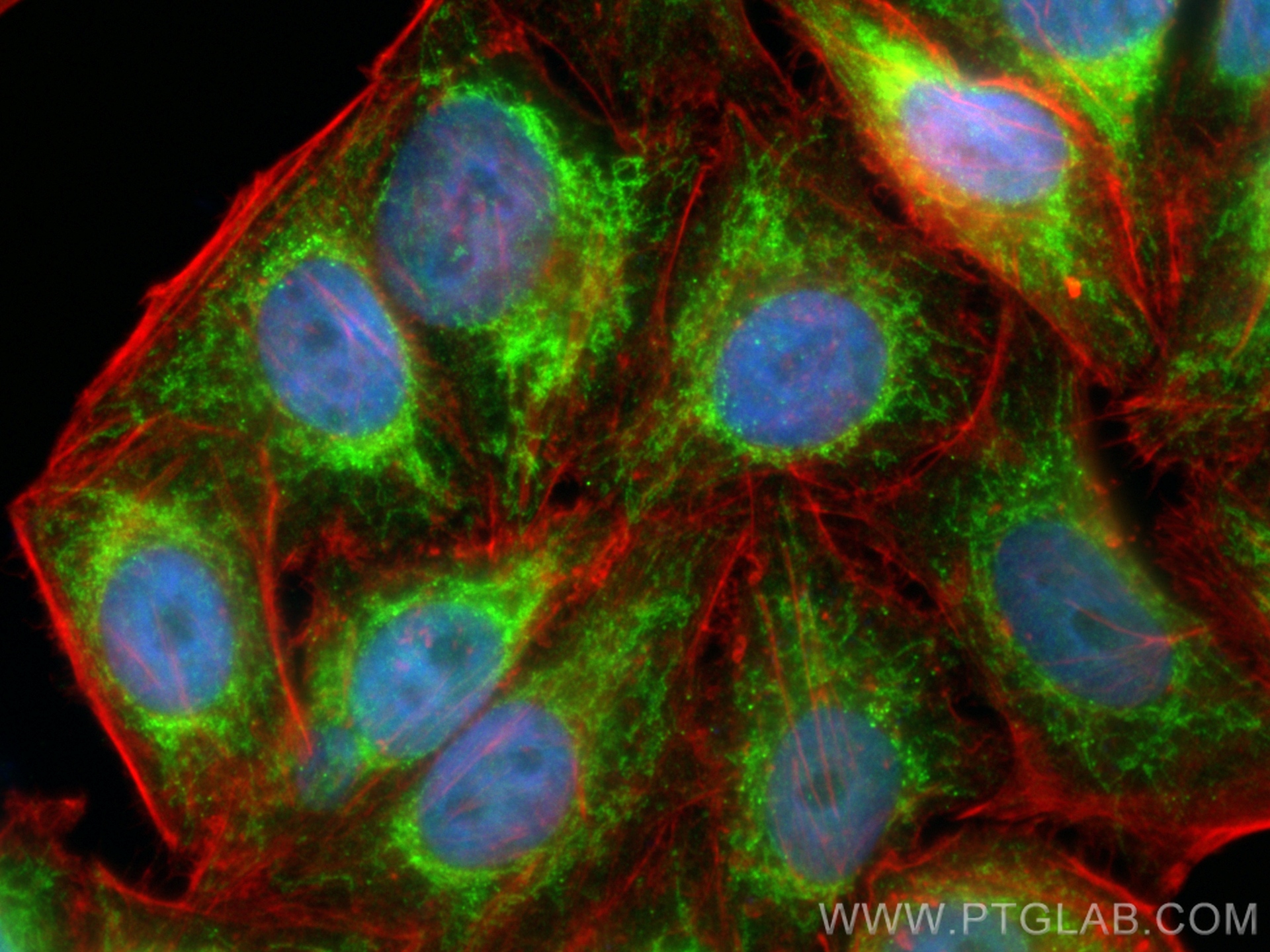 IF Staining of HepG2 using 17280-1-AP