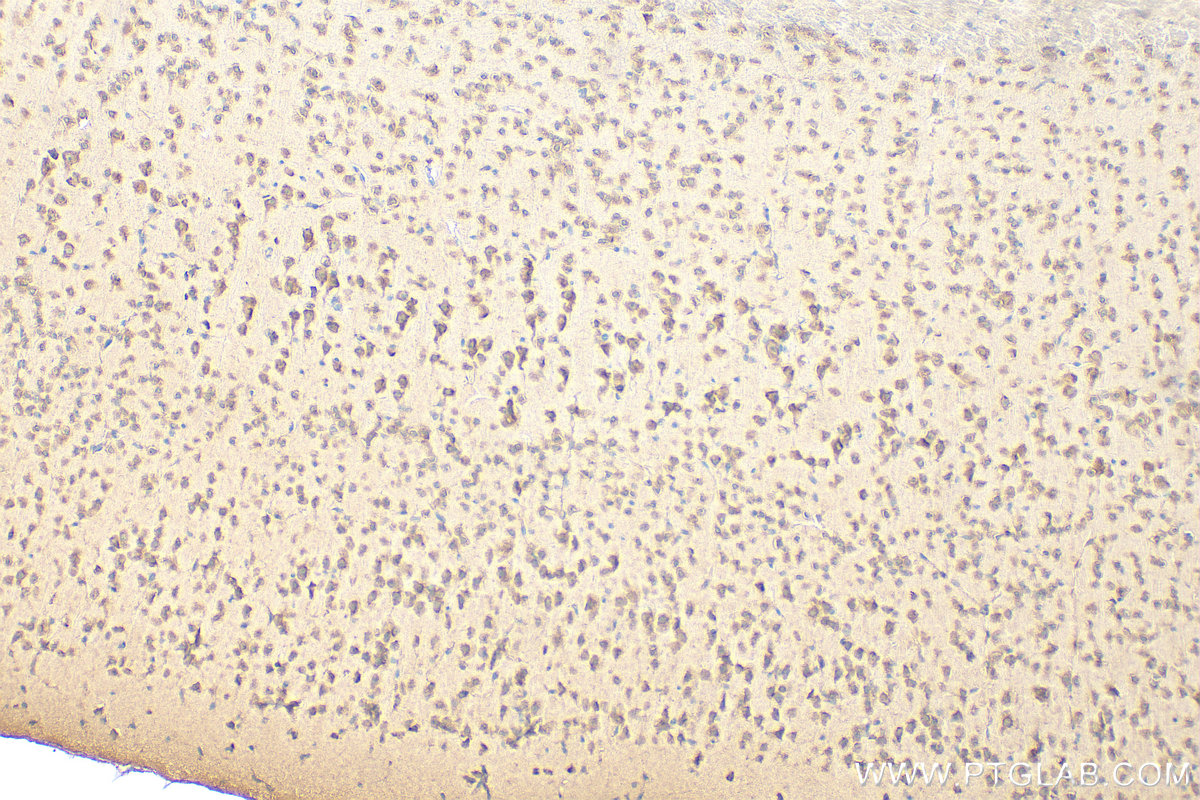 IHC staining of mouse brain using 17280-1-AP