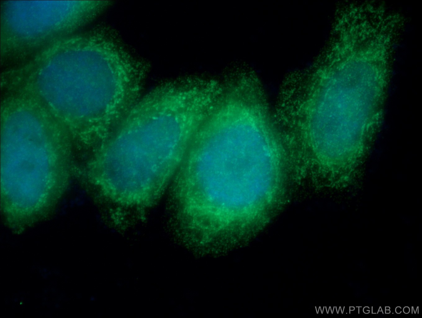 IF Staining of HepG2 using 18441-1-AP