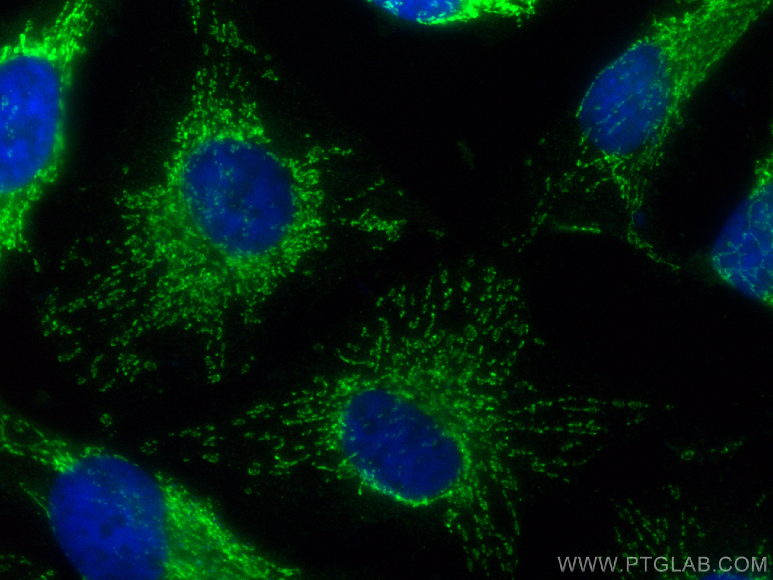 IF Staining of HeLa using CL488-16288