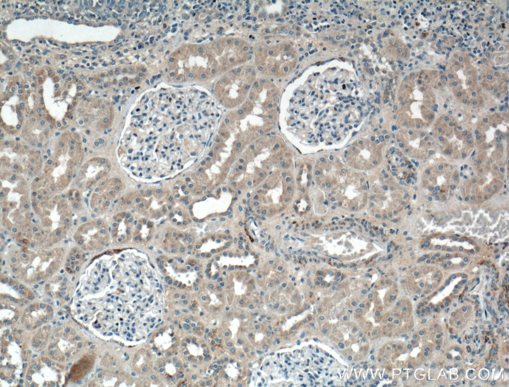 IHC staining of human kidney using 16428-1-AP