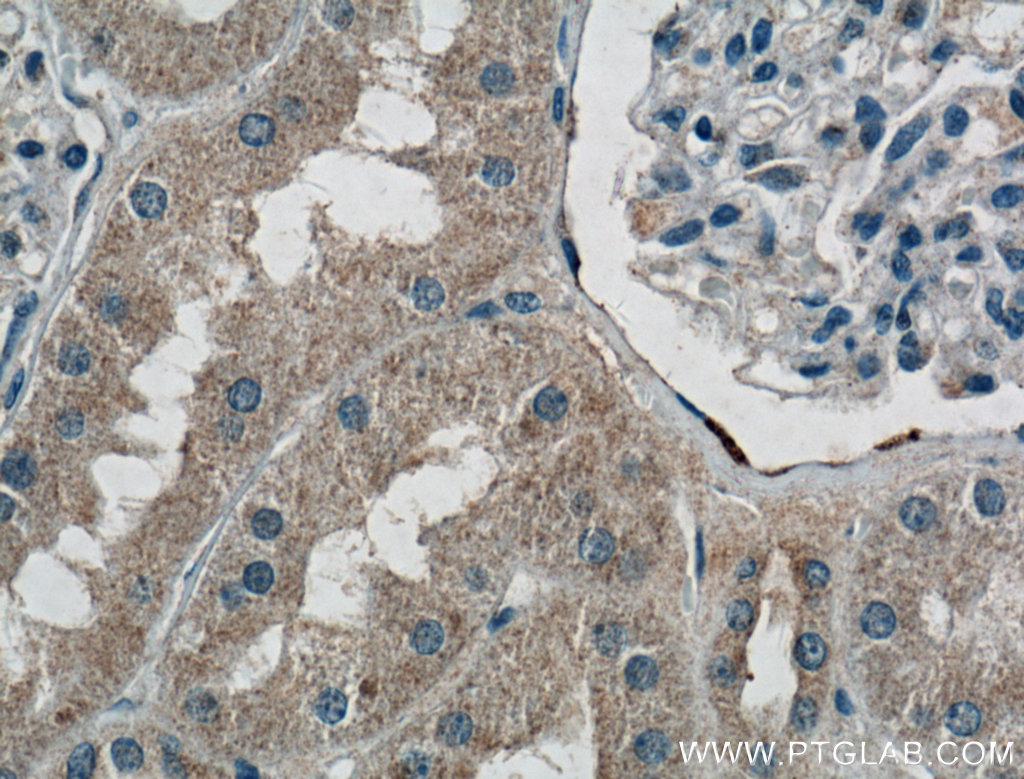 IHC staining of human kidney using 16428-1-AP