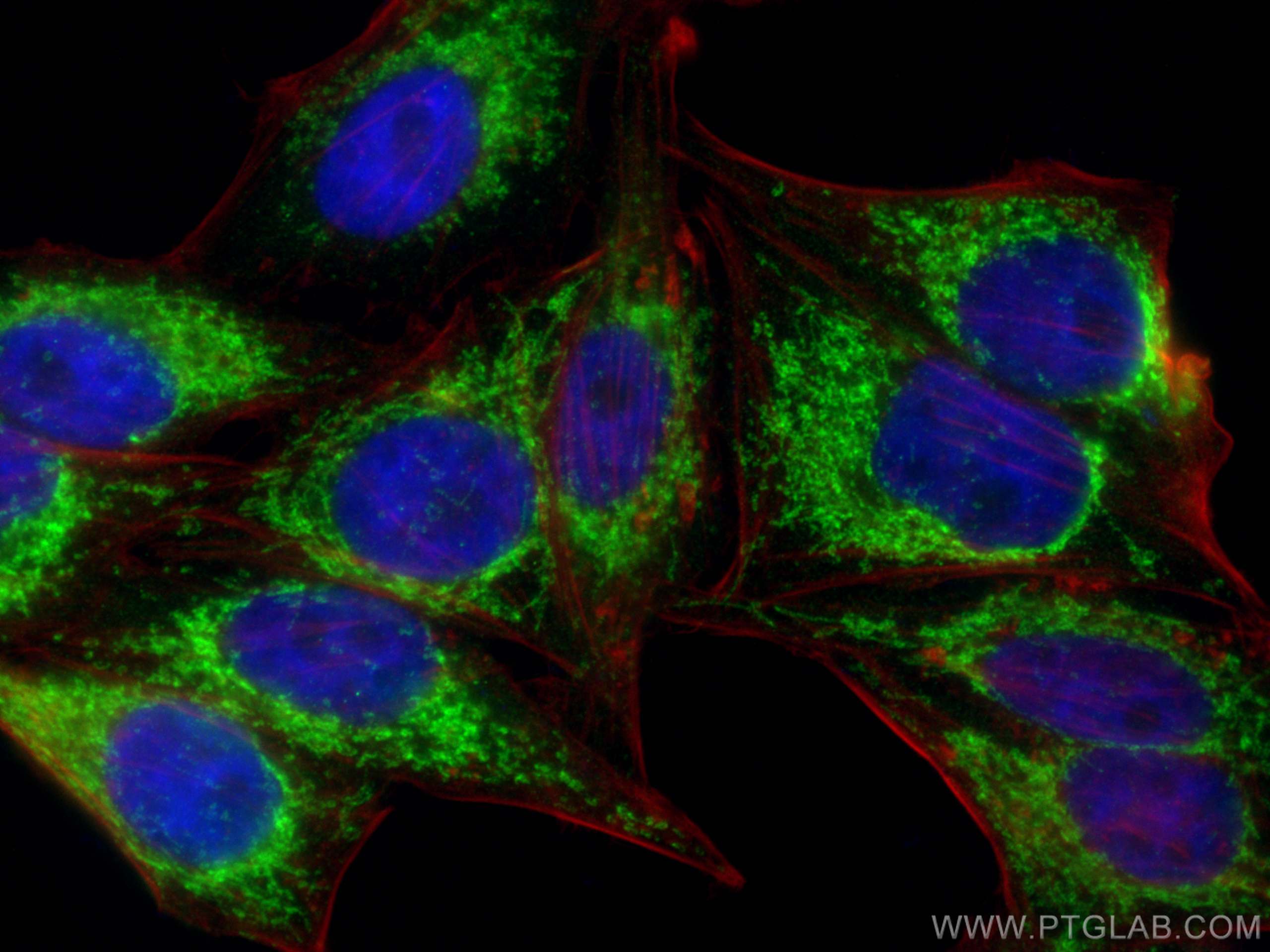 IF Staining of HepG2 using 16273-1-AP